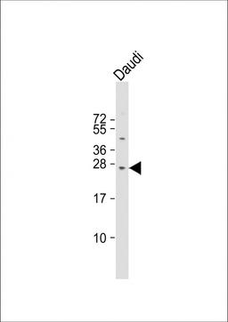 Western Blot at 1:1000 dilution + Daudi whole cell lysate Lysates/proteins at 20 ug per lane.