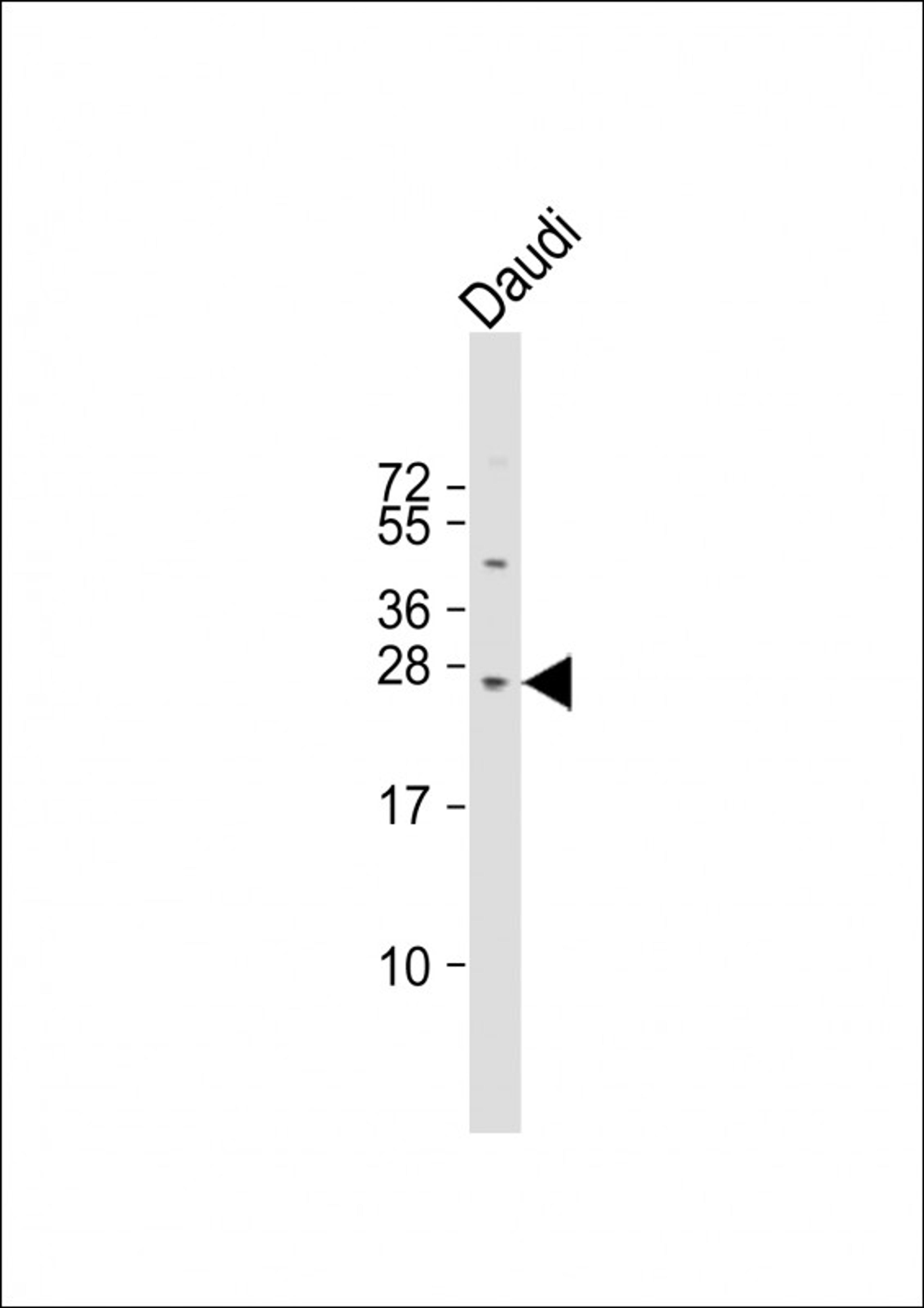 Western Blot at 1:1000 dilution + Daudi whole cell lysate Lysates/proteins at 20 ug per lane.