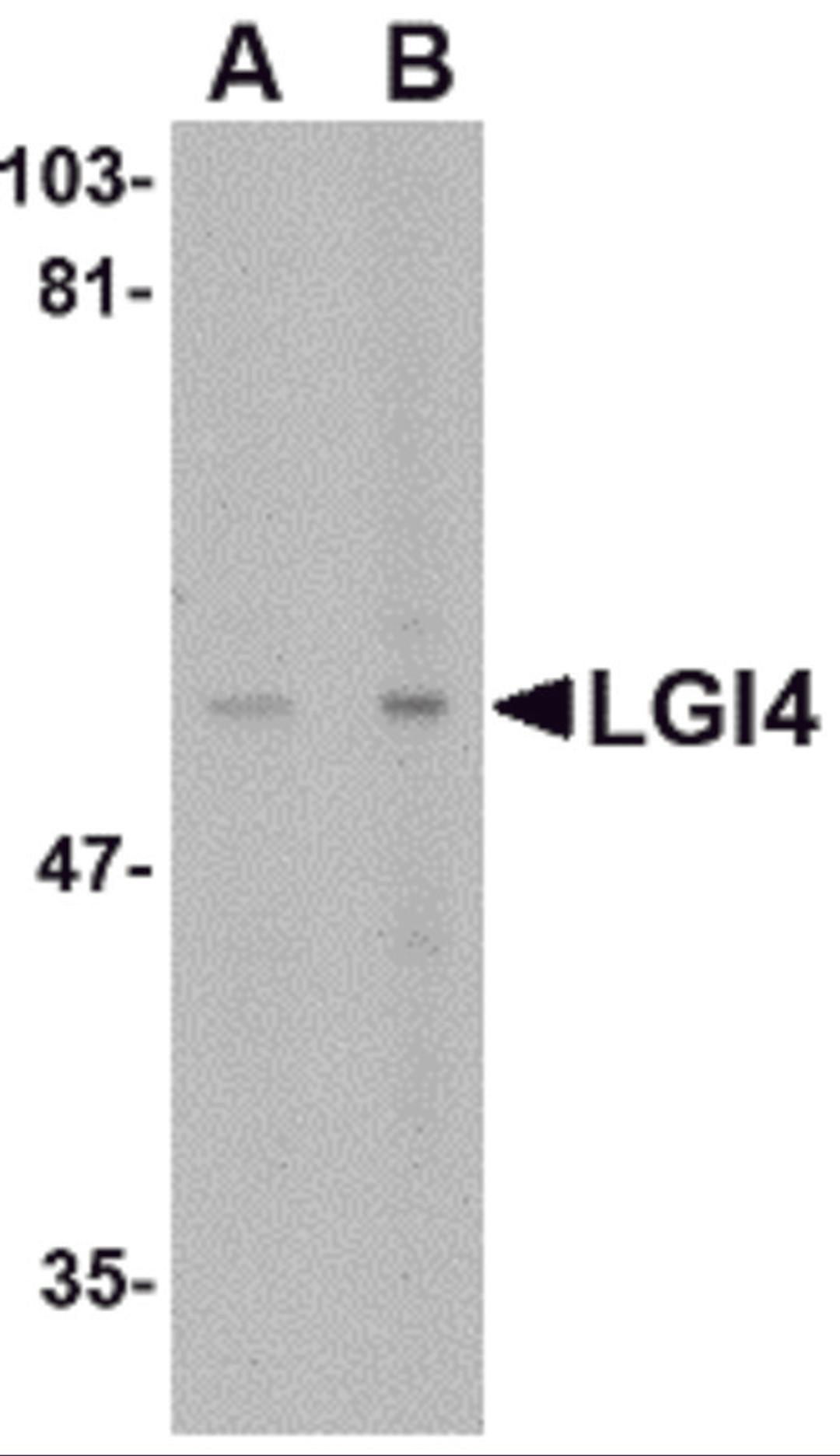 Western blot analysis of LGI4 in rat brain tissue lysate with LGI4 antibody at (A) 1 and (B) 2 &#956;g/mL.