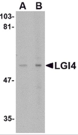 Western blot analysis of LGI4 in rat brain tissue lysate with LGI4 antibody at (A) 1 and (B) 2 μg/mL.