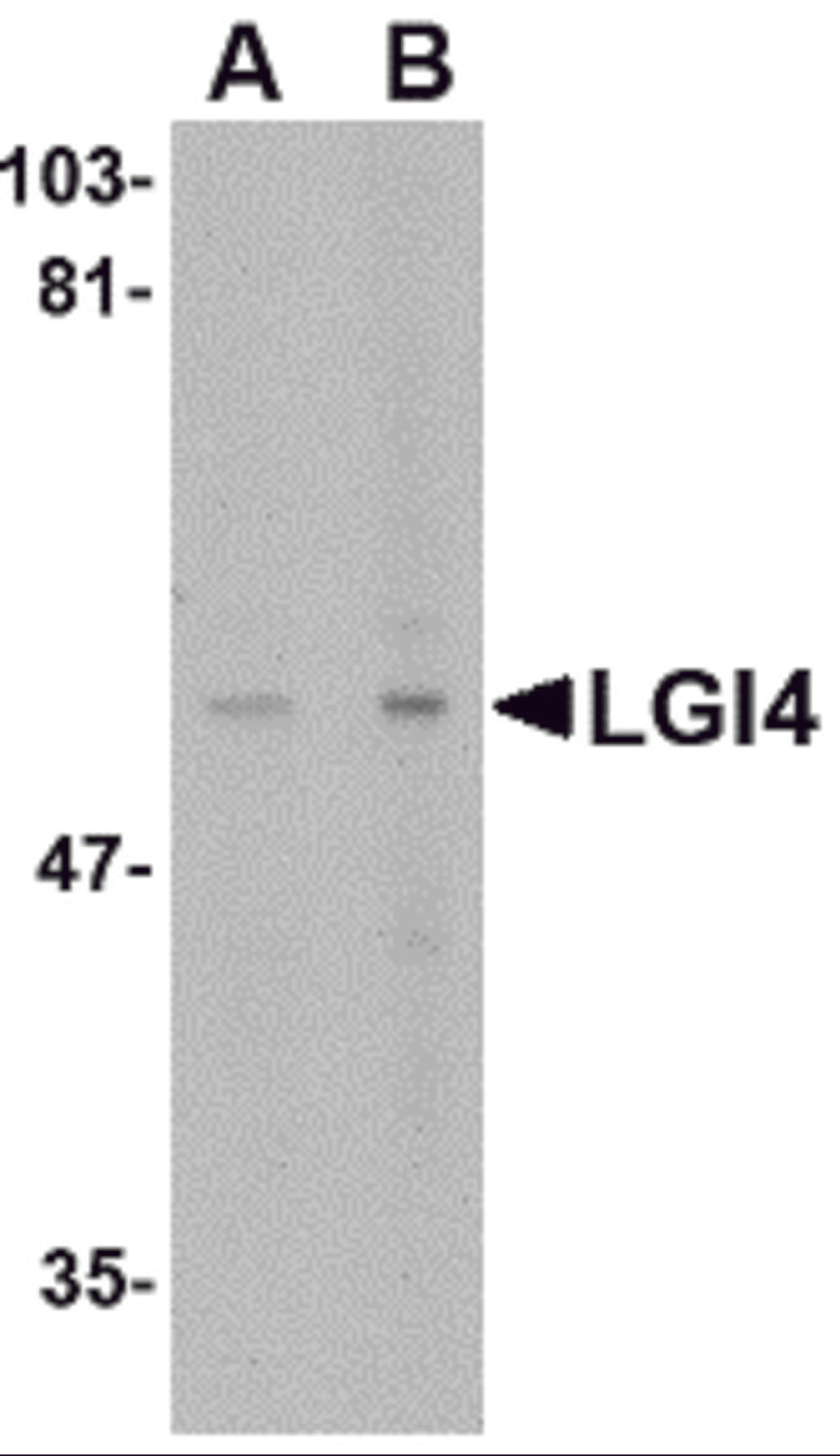 Western blot analysis of LGI4 in rat brain tissue lysate with LGI4 antibody at (A) 1 and (B) 2 μg/mL.