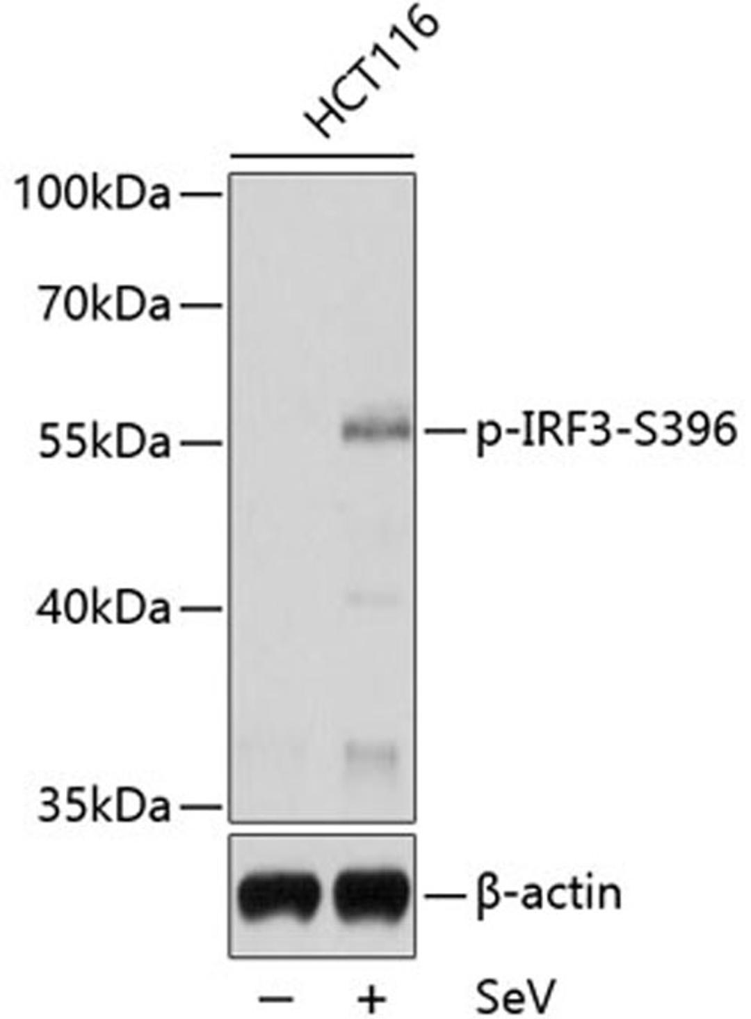 Western blot - Phospho-IRF3-S396 antibody (AP0623)