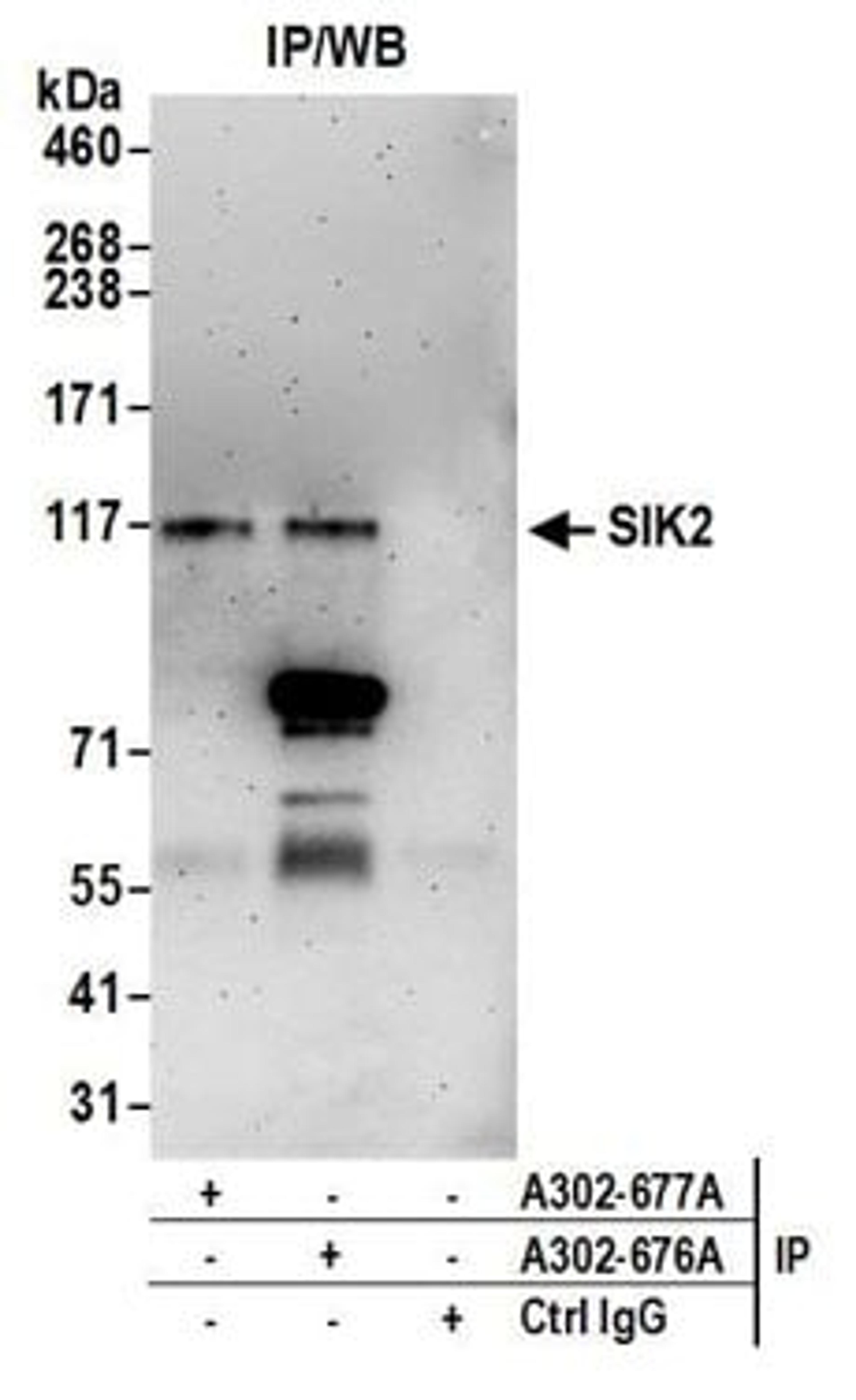 Detection of human SIK2 by western blot of immunoprecipitates.