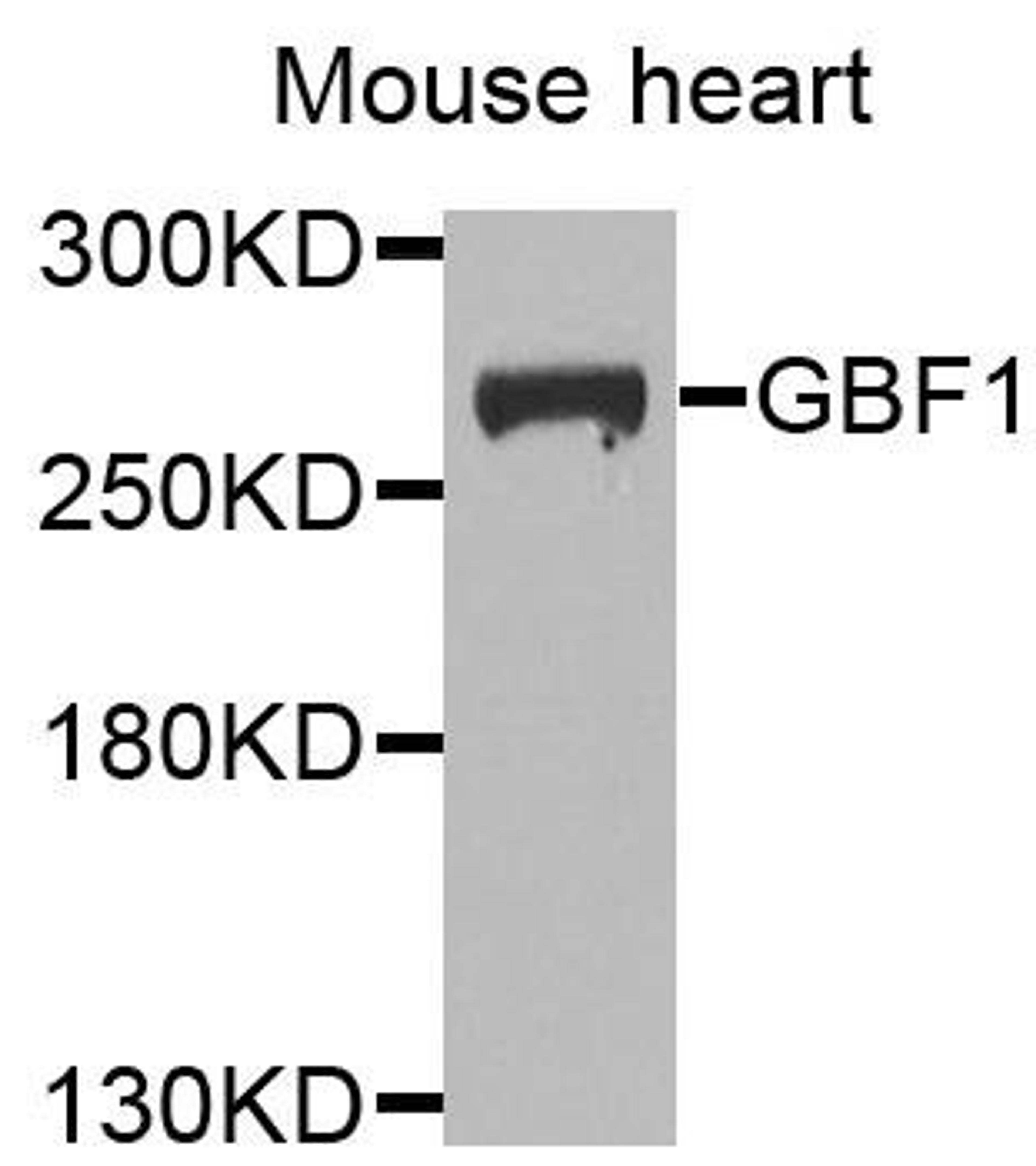 Western blot analysis of extracts of mouse heart cells using GBF1 antibody