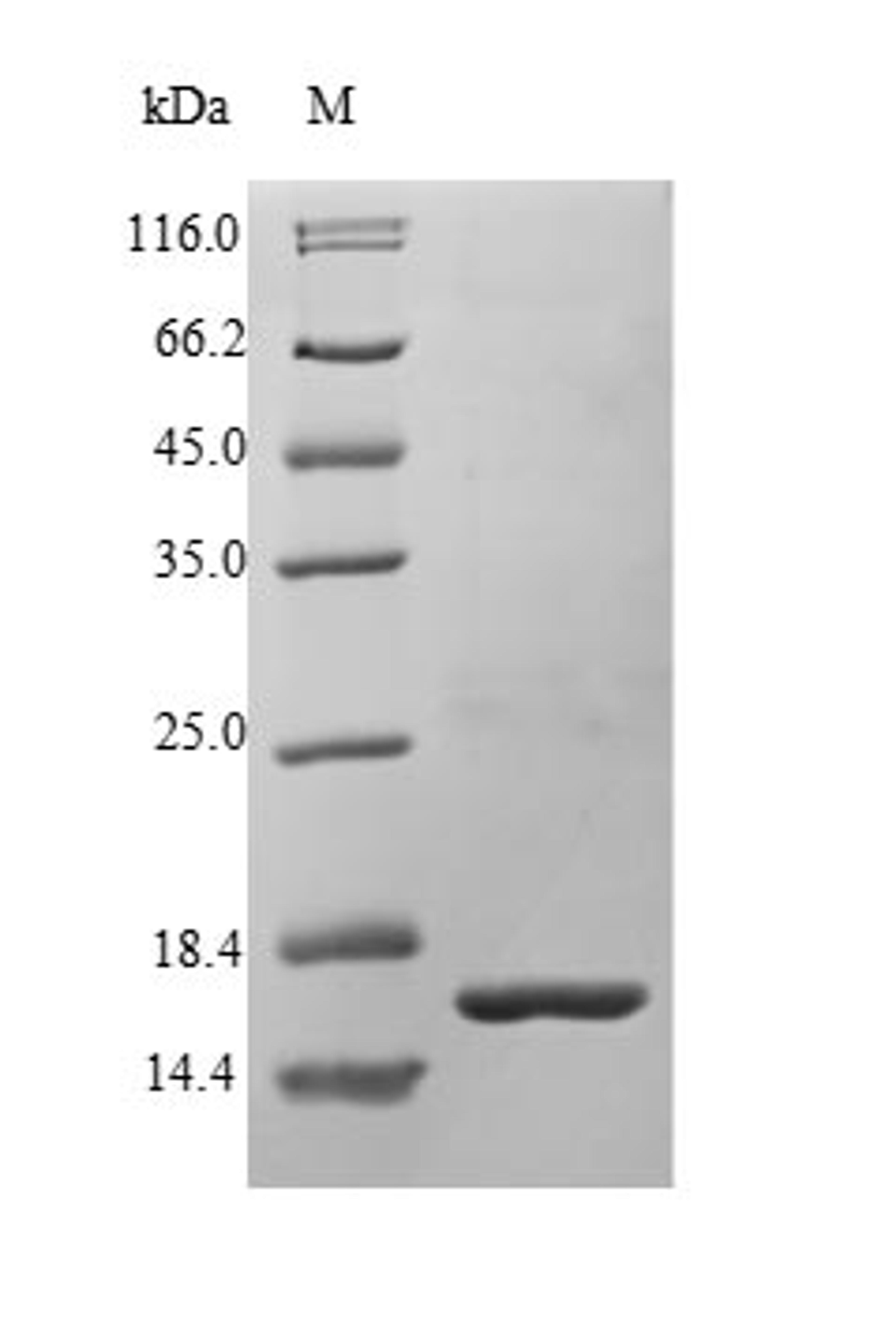 (Tris-Glycine gel) Discontinuous SDS-PAGE (reduced) with 5% enrichment gel and 15% separation gel.