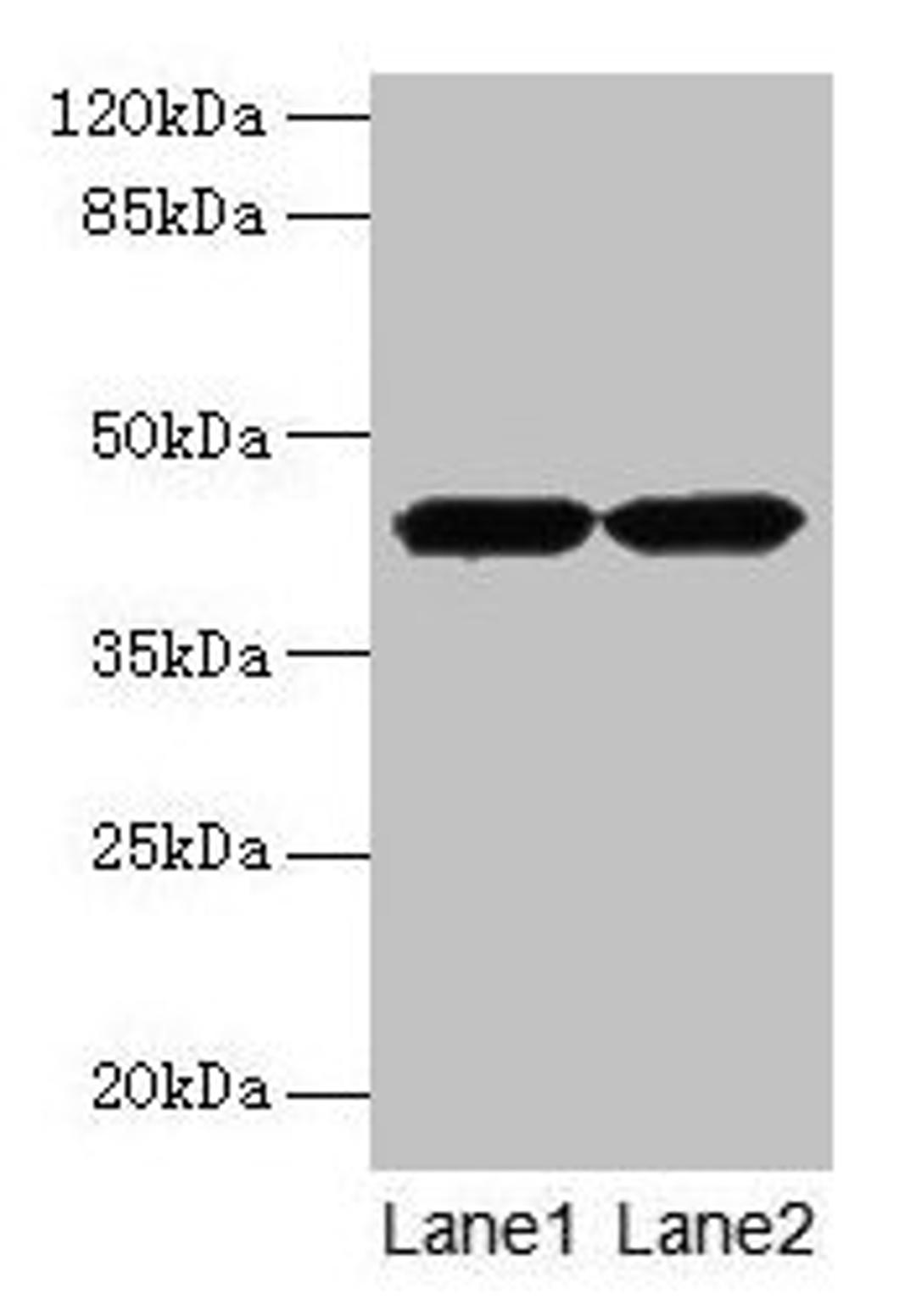 Western blot. All lanes: ACTRT2 antibody at 6µg/ml. Lane 1: HepG2 whole cell lysate. Lane 2: A431 whole cell lysate. Secondary. Goat polyclonal to rabbit IgG at 1/10000 dilution. Predicted band size: 42 kDa. Observed band size: 42 kDa