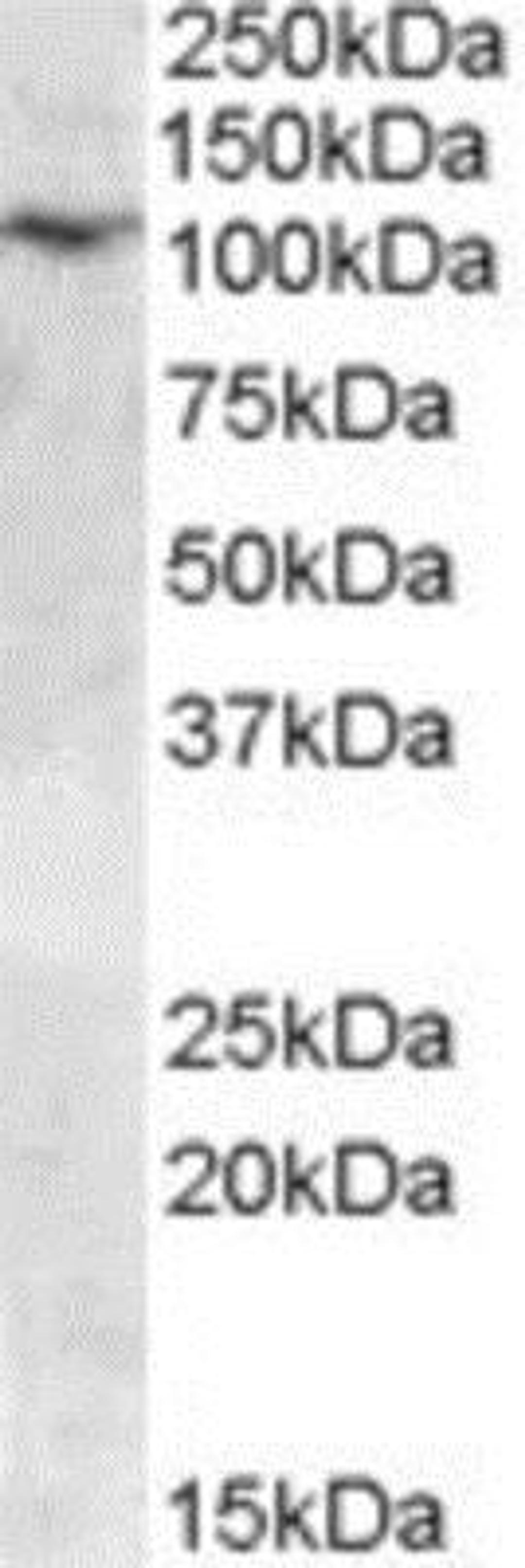 Western Blot: TRPC6 Antibody [NBP1-00142] - Analysis of TRPC6 in human placenta lysate (35ug protein in RIPA buffer) using this antibody at 0.03 ug/ml. Primary incubation was 1 hour. Detected by chemiluminescence.