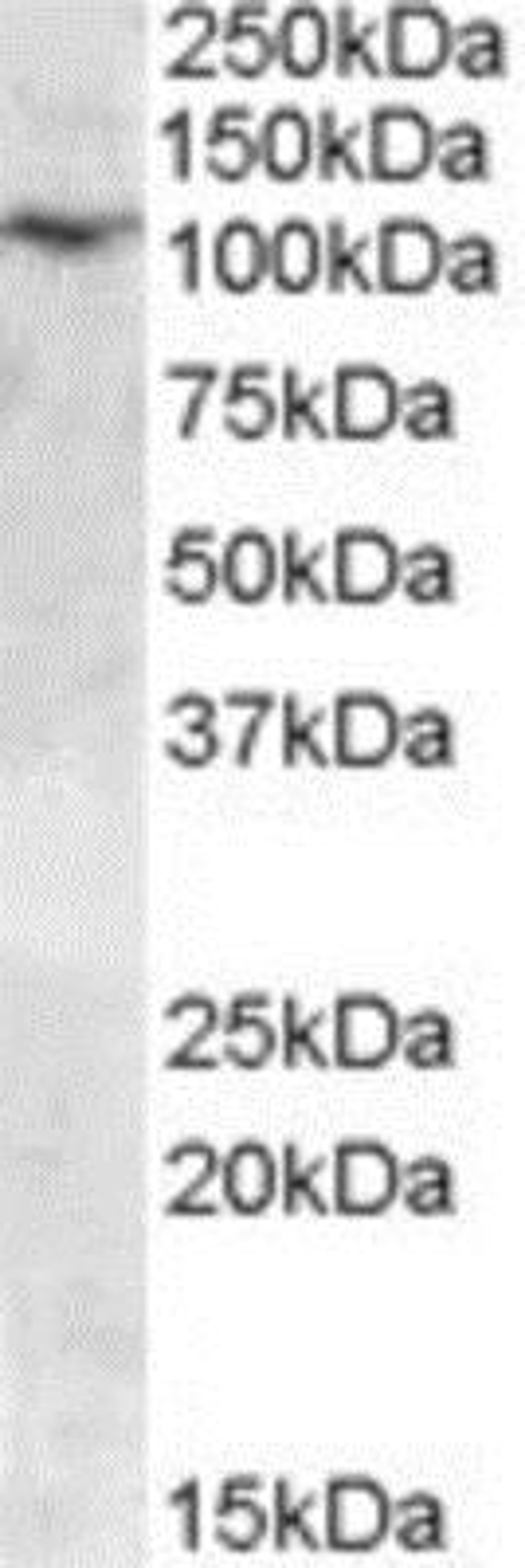 Western Blot: TRPC6 Antibody [NBP1-00142] - Analysis of TRPC6 in human placenta lysate (35ug protein in RIPA buffer) using this antibody at 0.03 ug/ml. Primary incubation was 1 hour. Detected by chemiluminescence.