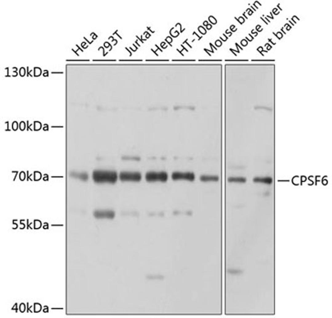 Western blot - CPSF6 antibody (A5963)