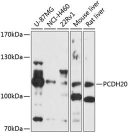 Western blot - PCDH20 antibody (A10428)