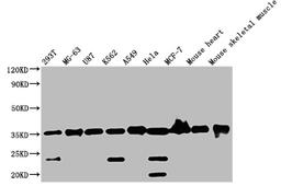 Western Blot. Positive WB detected in: Mouse skeletal muscle tissue. All lanes: ANKRD23 antibody at 2.5µg/ml. Secondary. Goat polyclonal to rabbit IgG at 1/50000 dilution. Predicted band size: 35, 30 kDa. Observed band size: 35 kDa