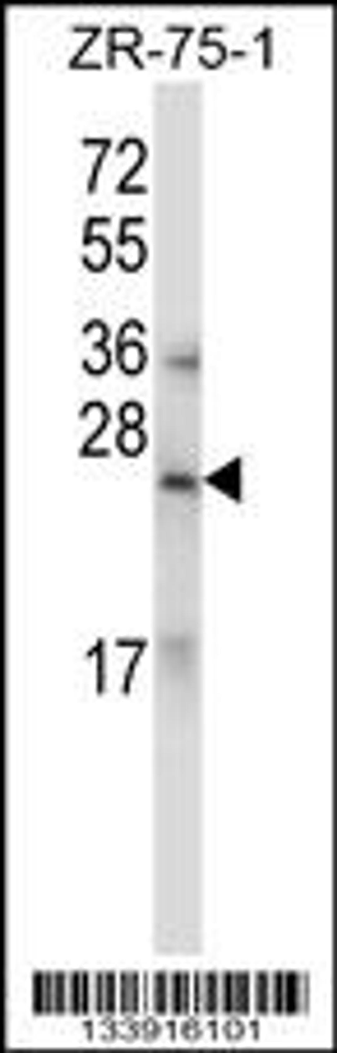 Western blot analysis in ZR-75-1 cell line lysates (35ug/lane).