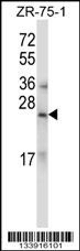 Western blot analysis in ZR-75-1 cell line lysates (35ug/lane).