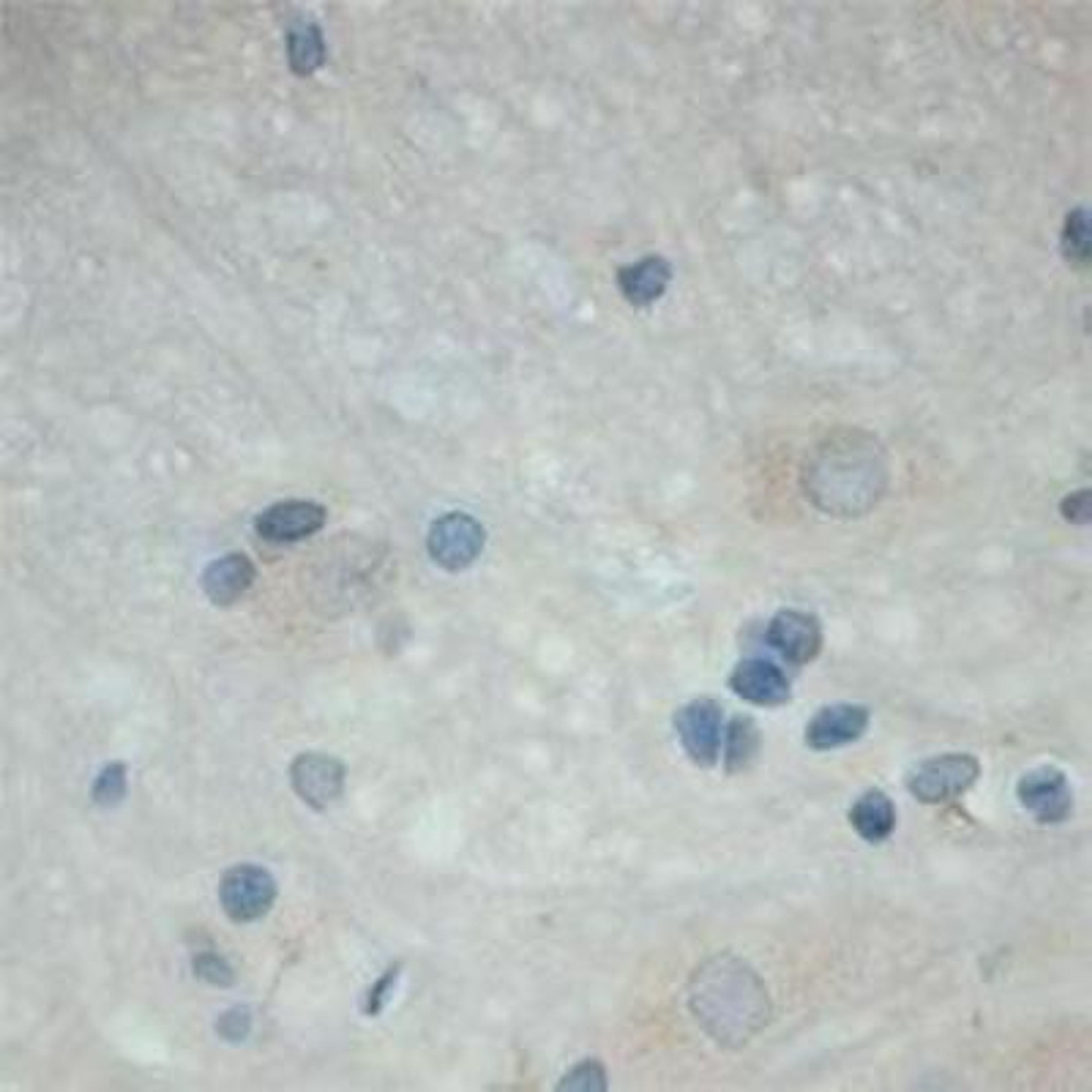 Immunohistochemistry: TrkC Antibody [NB100-98829] - IHC on rat spinal cord (paraffin section) using Rabbit antibody to extracellular domain of TrkC (Trk-C, NTRK3, NT-3 growth factor receptor): whole serum at 1 : 200 dilution incubated overnight at 4C, developed with DAB/No and counterstained with hematoxylin.