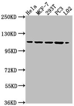 Western Blot. Positive WB detected in: HeLa whole cell lysate, MCF-7 whole cell lysate, 293T whole cell lysate, PC3 whole cell lysate, L02 whole cell lysate. All lanes: CSE1L antibody at 1:2000. Secondary. Goat polyclonal to rabbit IgG at 1/50000 dilution. Predicted band size: 111, 23, 108, 104 kDa. Observed band size: 111 kDa.