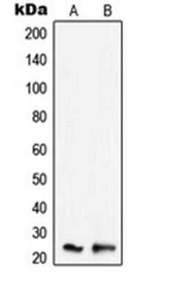 Western blot analysis of K562 (Lane 1), Raw264.7 (Lane 2) whole cell lysates using TNFAIP8 antibody