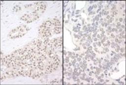 Detection of human and mouse PQBP1 by immunohistochemistry.