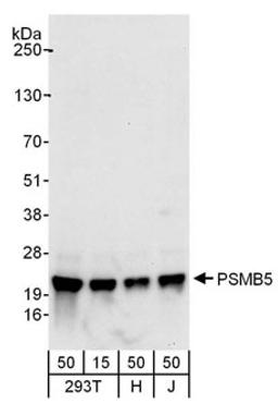 Detection of human PSMB5 by western blot.