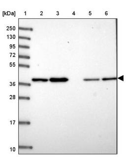 Western Blot: THOC3 Antibody [NBP1-92502] - Lane 1: Marker [kDa] 250, 130, 95, 72, 55, 36, 28, 17, 10<br/>Lane 2: Human cell line RT-4<br/>Lane 3: Human cell line U-251MG sp<br/>Lane 4: Human plasma (IgG/HSA depleted)<br/>Lane 5: Human liver tissue<br/>Lane 6: Human tonsil tissue