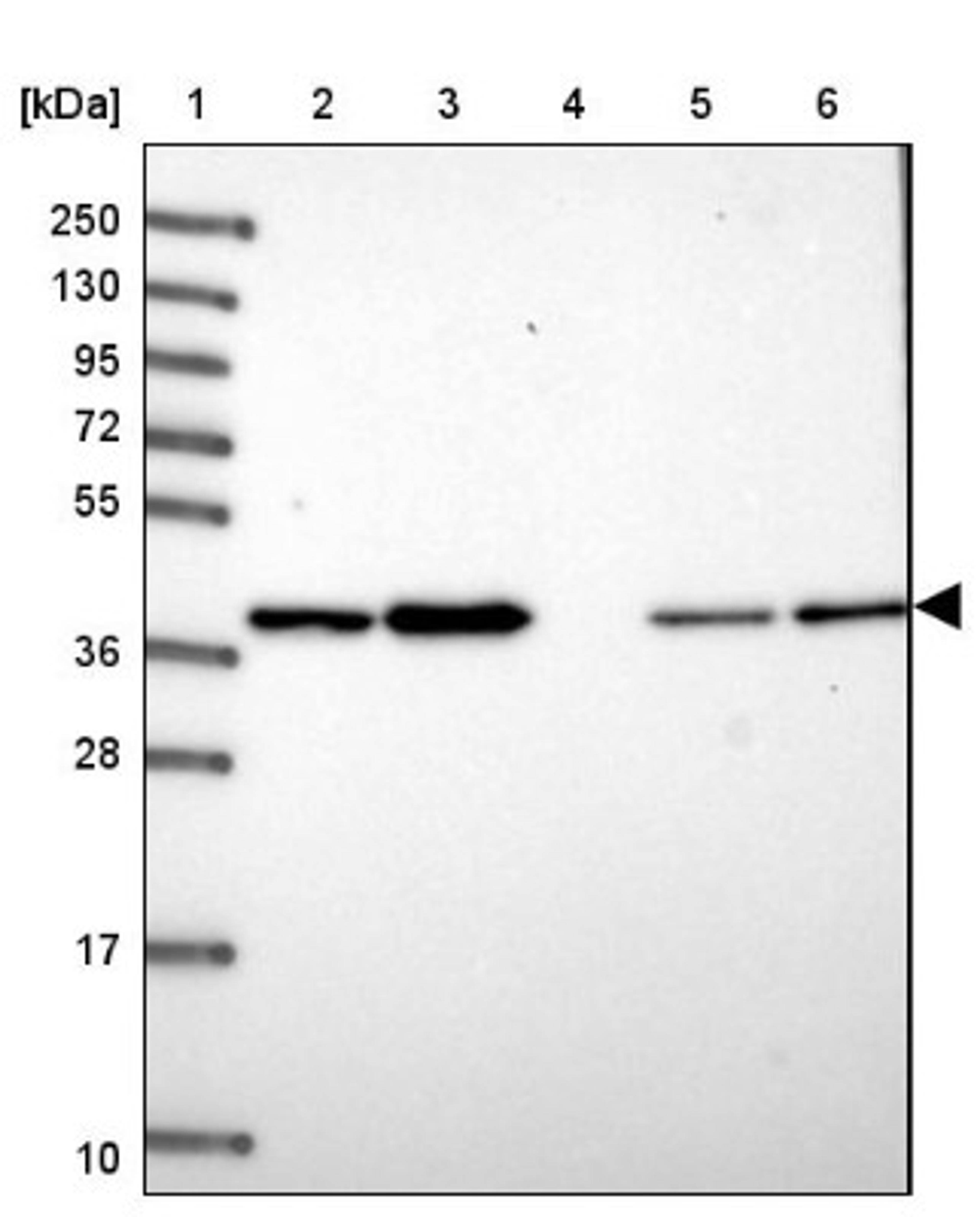 Western Blot: THOC3 Antibody [NBP1-92502] - Lane 1: Marker [kDa] 250, 130, 95, 72, 55, 36, 28, 17, 10<br/>Lane 2: Human cell line RT-4<br/>Lane 3: Human cell line U-251MG sp<br/>Lane 4: Human plasma (IgG/HSA depleted)<br/>Lane 5: Human liver tissue<br/>Lane 6: Human tonsil tissue