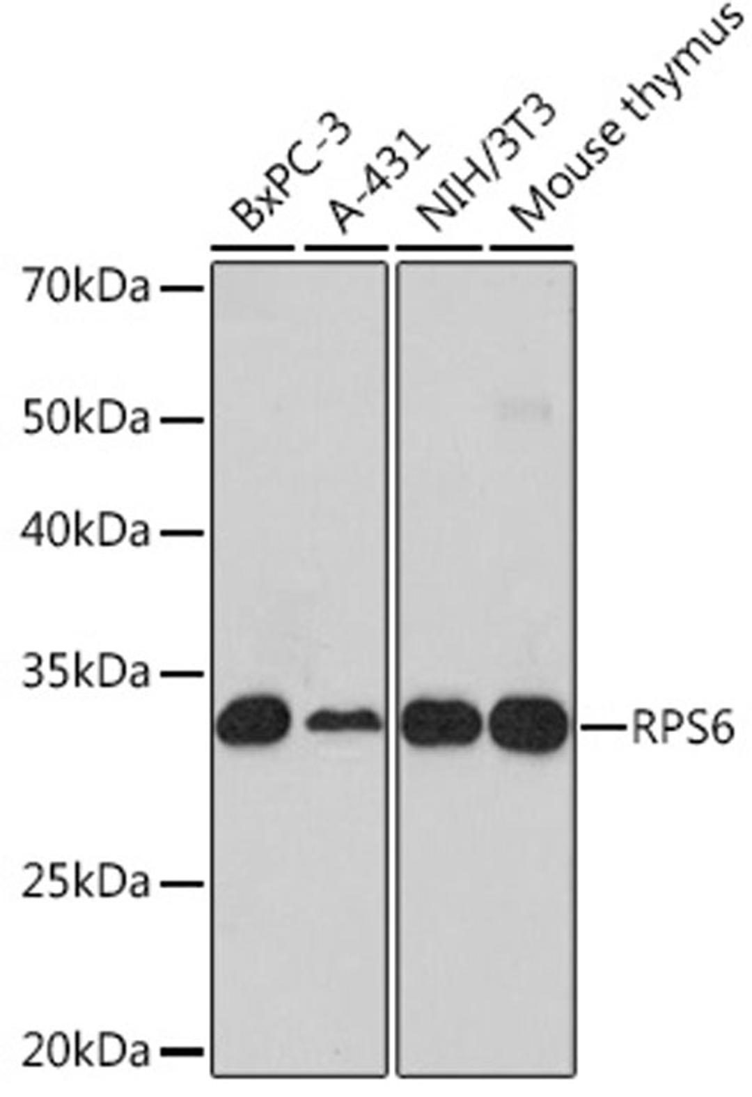 Western blot - RPS6 antibody (A6058)