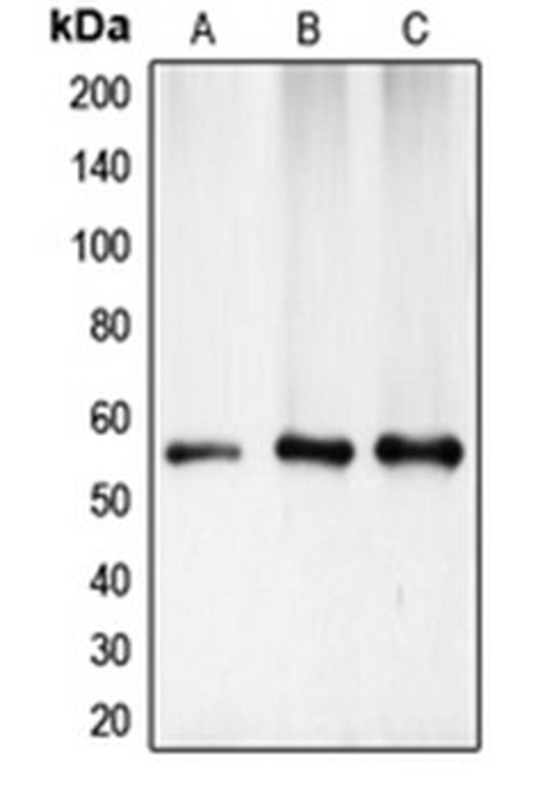 Western blot analysis of HeLa (Lane 1), mouse kidney (Lane 2), rat heart (Lane 3) whole cell lysates using CHEK1 antibody