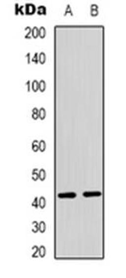 Western blot analysis of PEX10 expression in MCF7 (Lane 1), Jurkat (Lane 2) whole cell lysates using PEX10 antibody