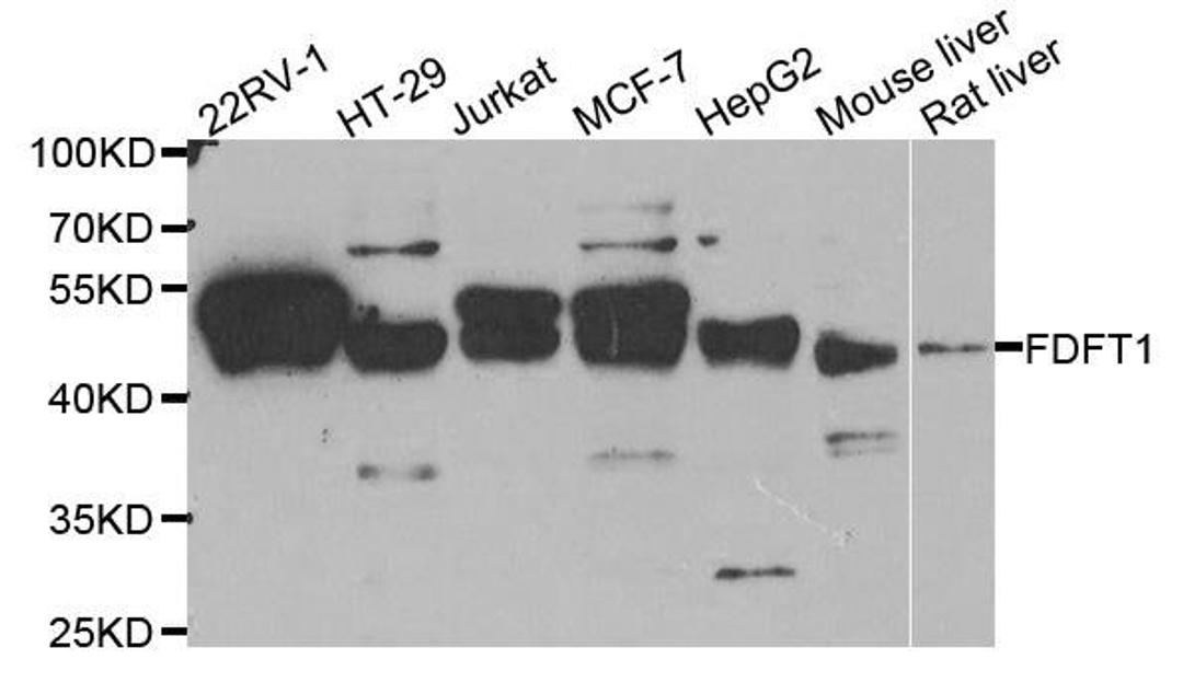 Western blot analysis of extracts of various cell lines using FDFT1 antibody