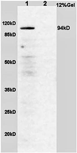 Western blot analysis of (line1) rat brain lysates (line2)rat lung lysates using B Raf (phospho-S365) antibody