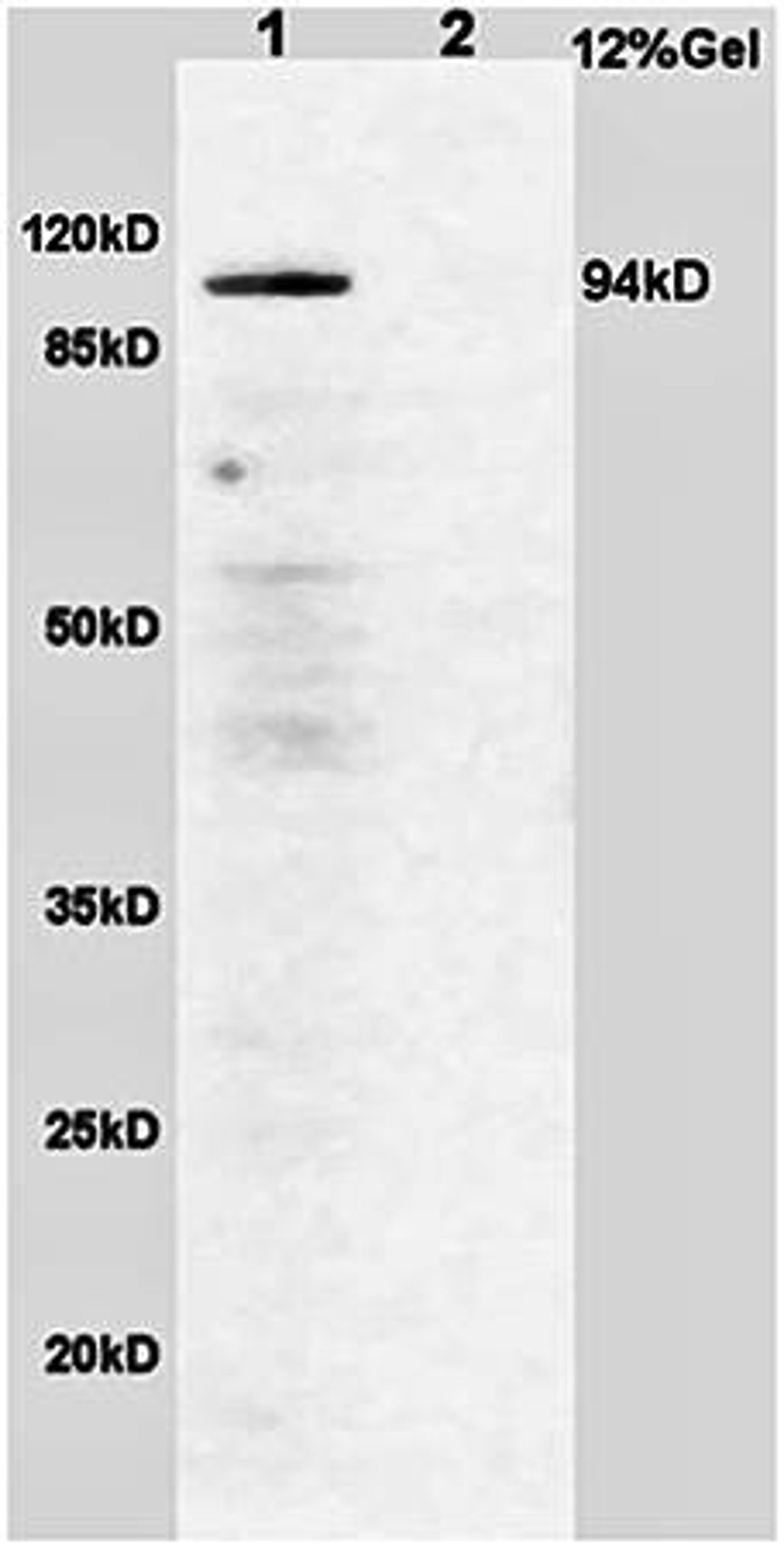 Western blot analysis of (line1) rat brain lysates (line2)rat lung lysates using B Raf (phospho-S365) antibody