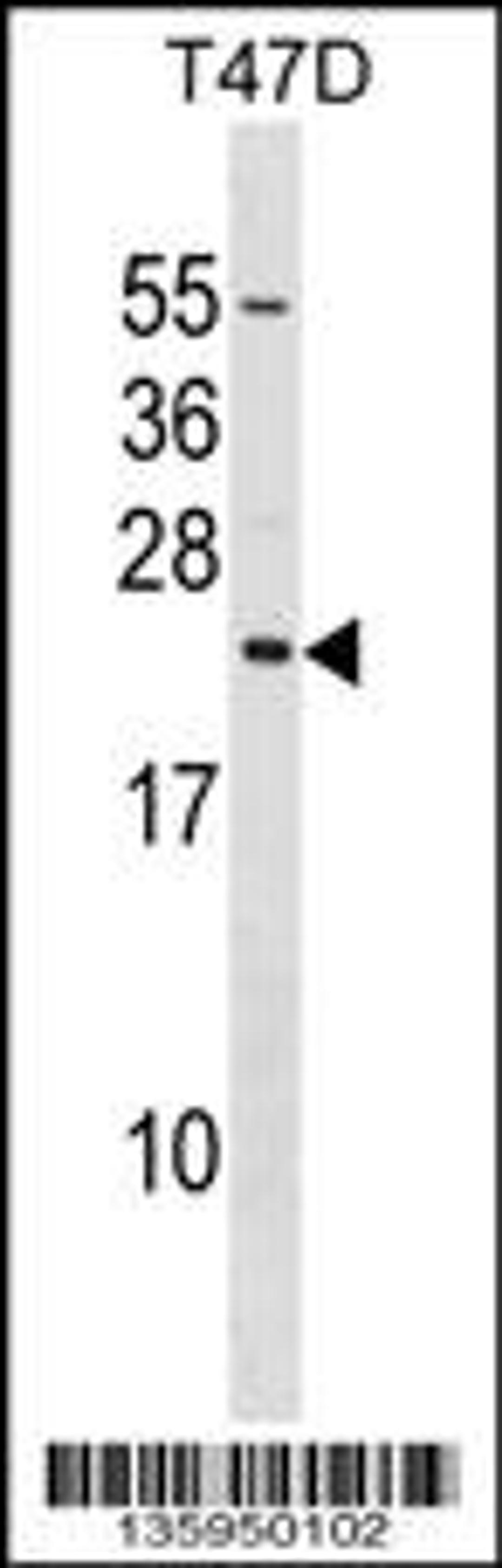 Western blot analysis in T47D cell line lysates (35ug/lane).