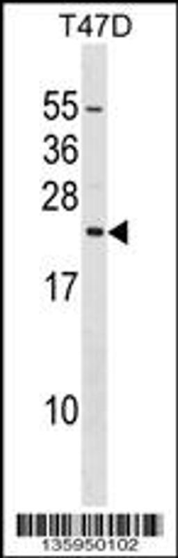 Western blot analysis in T47D cell line lysates (35ug/lane).