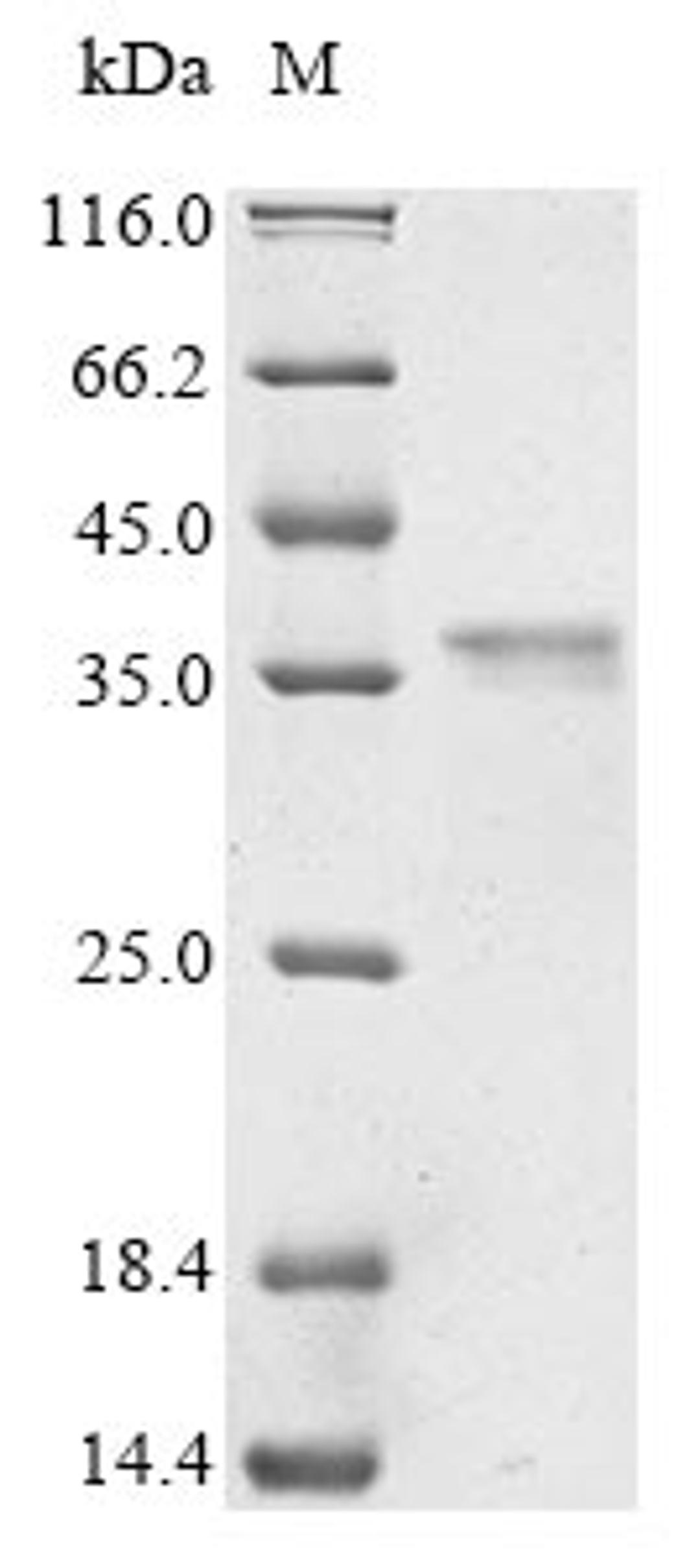 (Tris-Glycine gel) Discontinuous SDS-PAGE (reduced) with 5% enrichment gel and 15% separation gel.