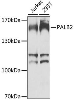 Western blot - PALB2 antibody (A8373)