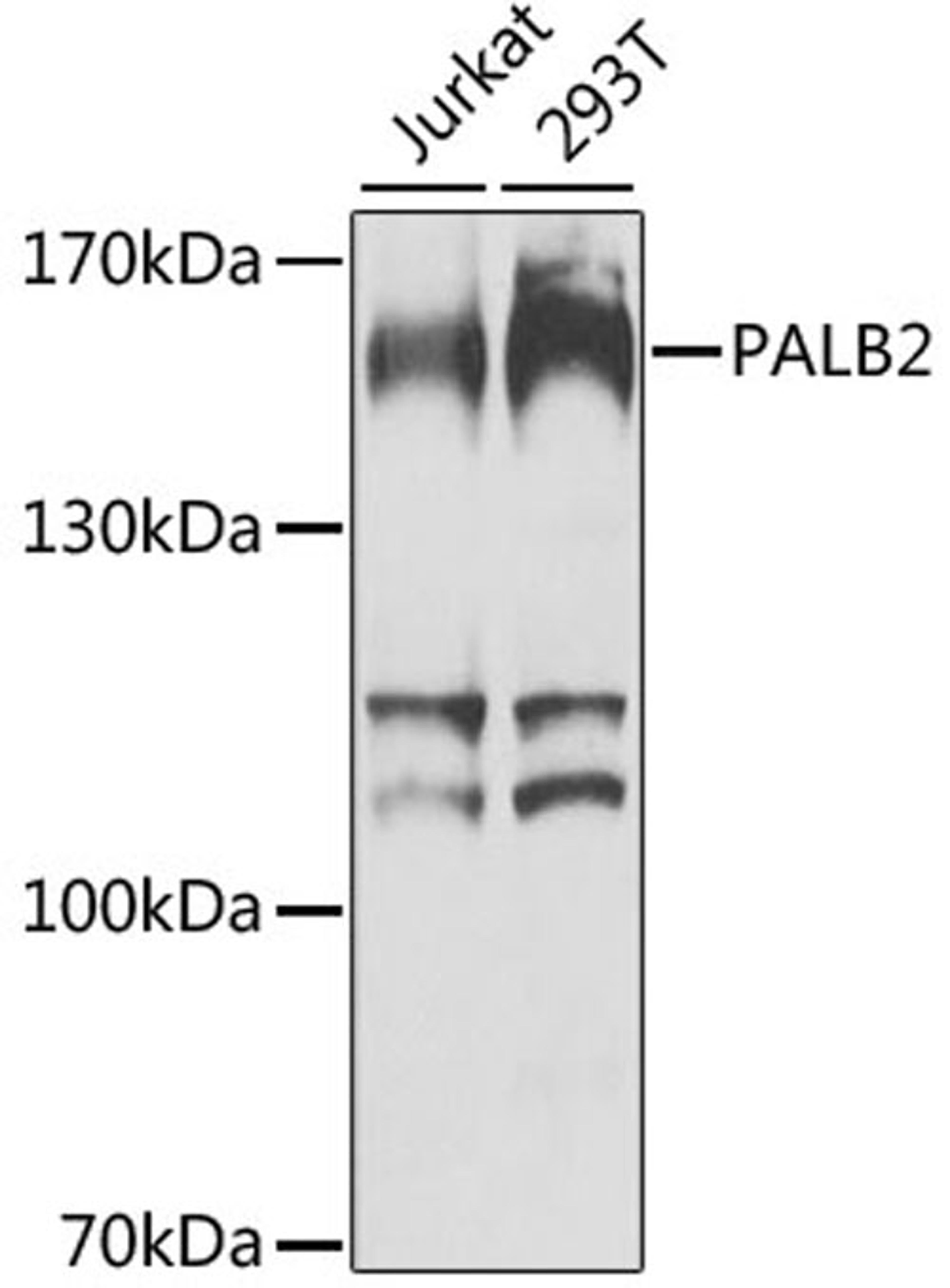 Western blot - PALB2 antibody (A8373)