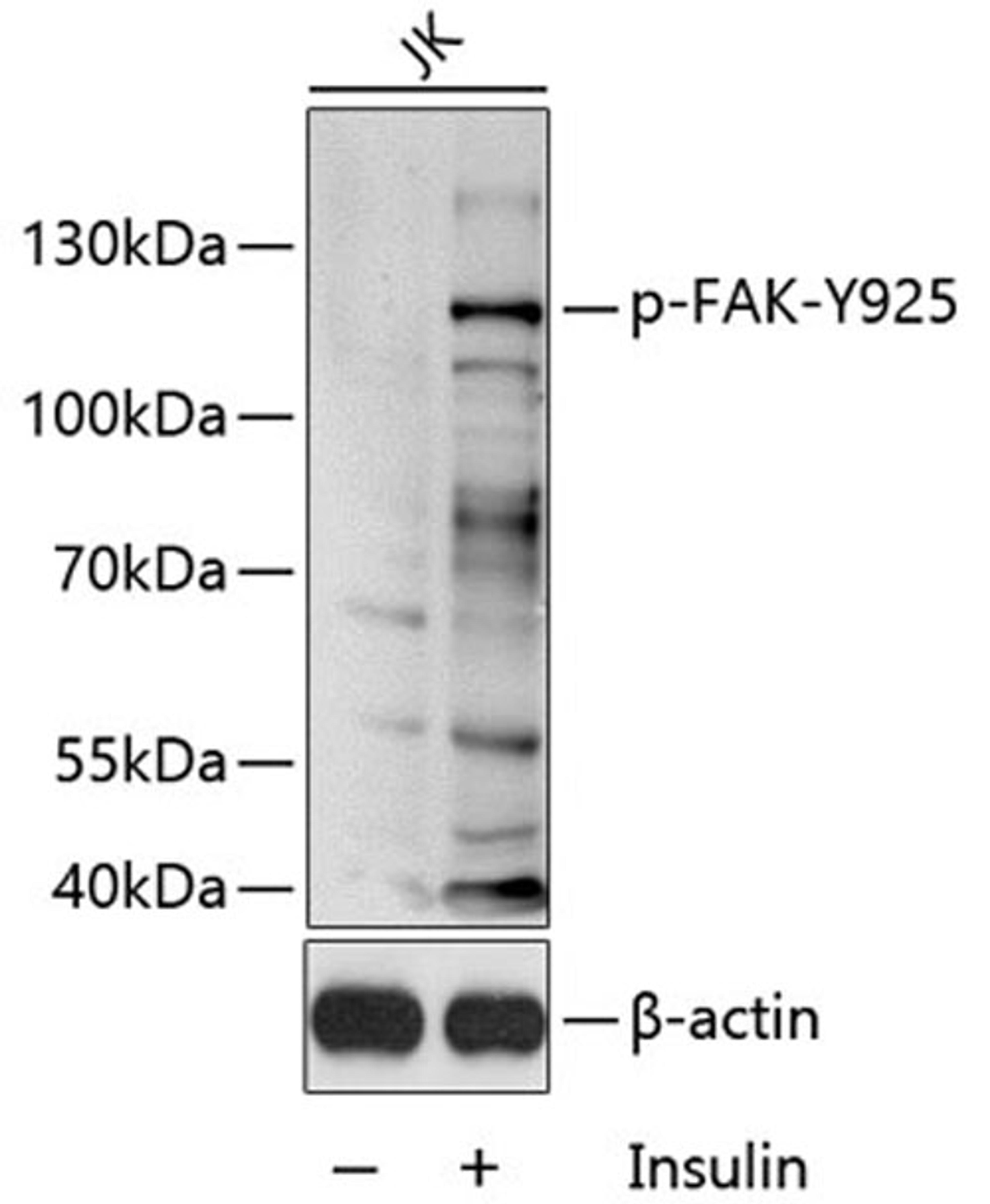 Western blot - Phospho-FAK-Y925 antibody (AP0599)