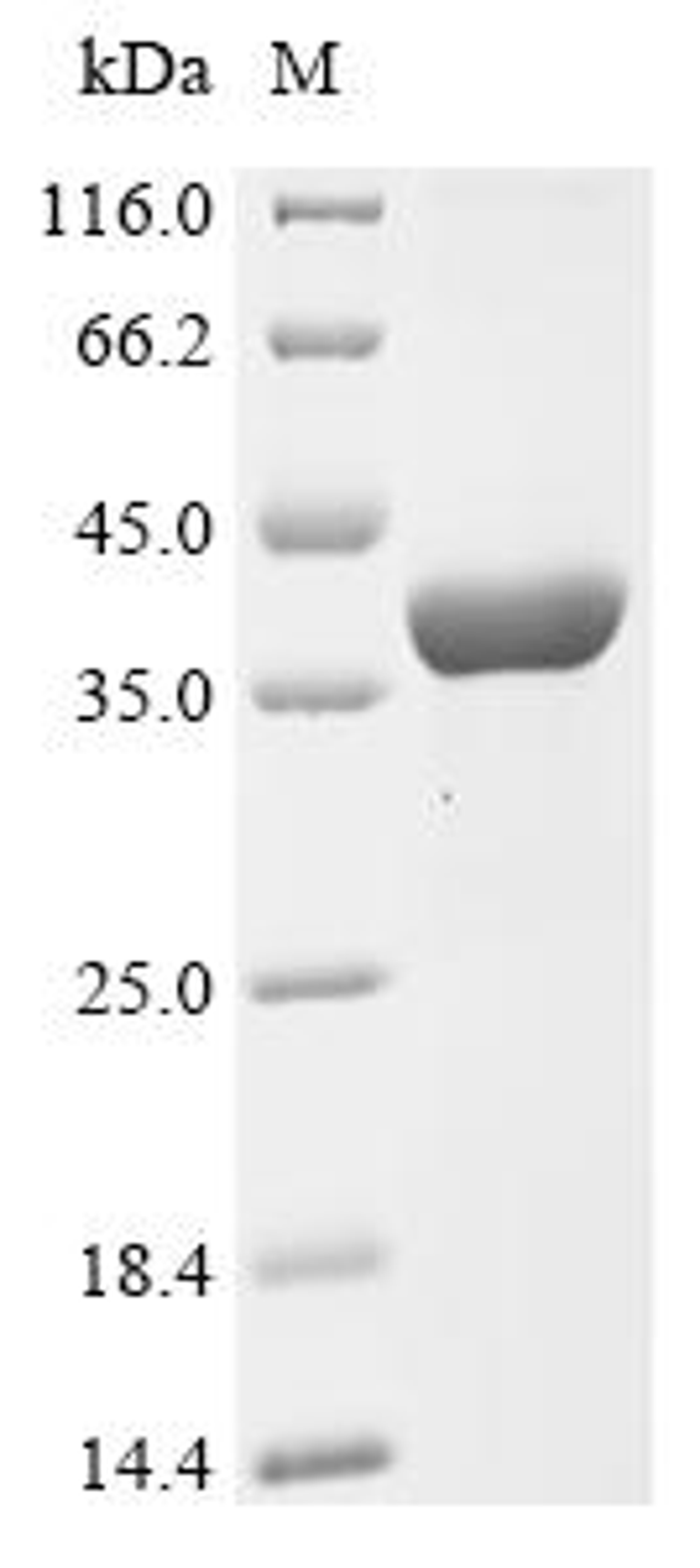 (Tris-Glycine gel) Discontinuous SDS-PAGE (reduced) with 5% enrichment gel and 15% separation gel.