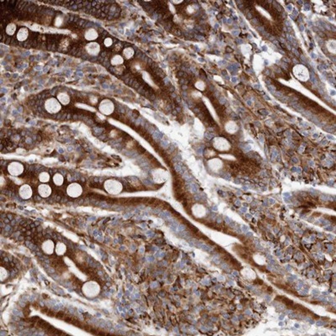 Immunohistochemistry-Paraffin: SEMA3E Antibody [NBP1-84408] - Staining of human duodenum shows strong cytoplasmic positivity in glandular cells.