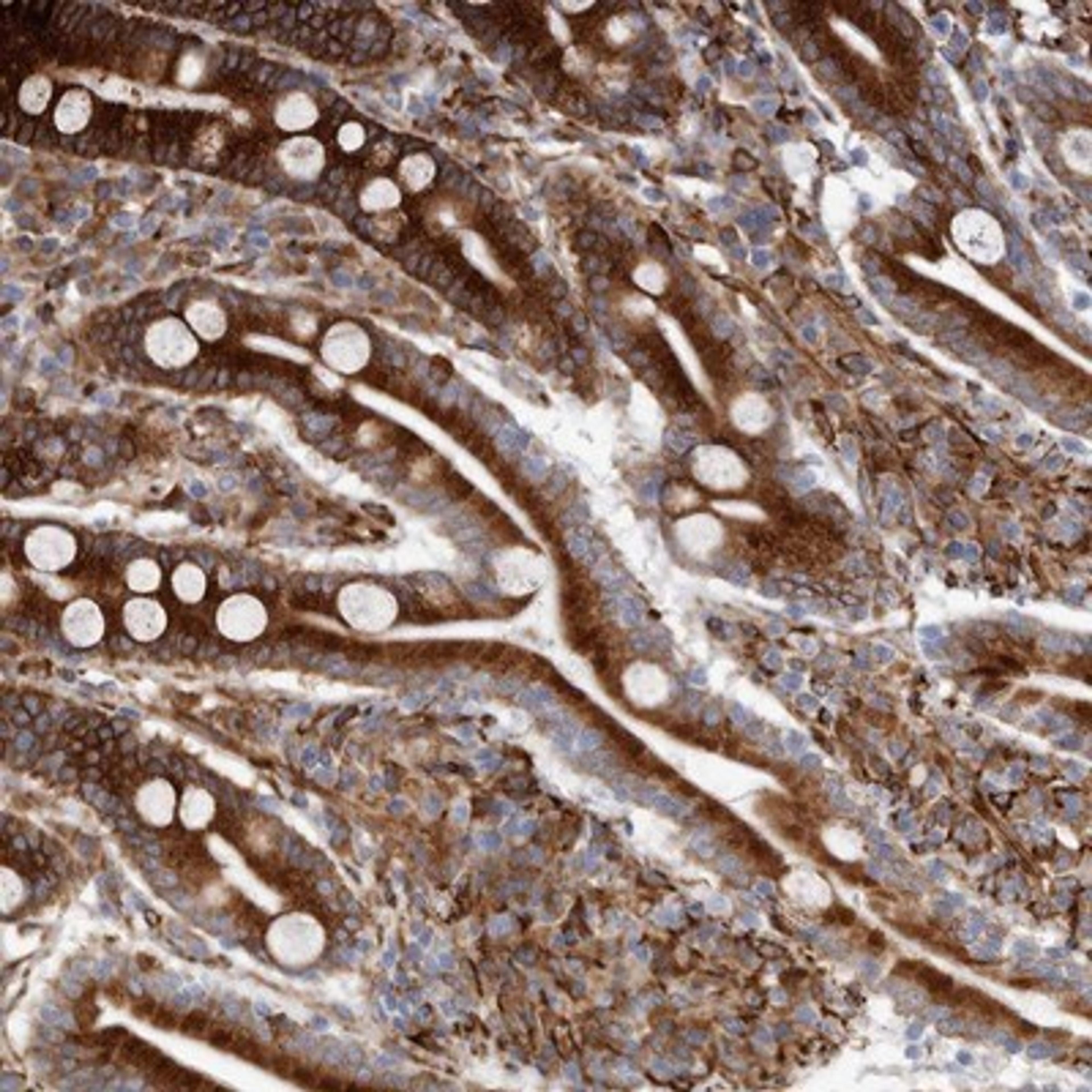 Immunohistochemistry-Paraffin: SEMA3E Antibody [NBP1-84408] - Staining of human duodenum shows strong cytoplasmic positivity in glandular cells.