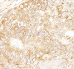 Detection of mouse RPL7 by immunohistochemistry.