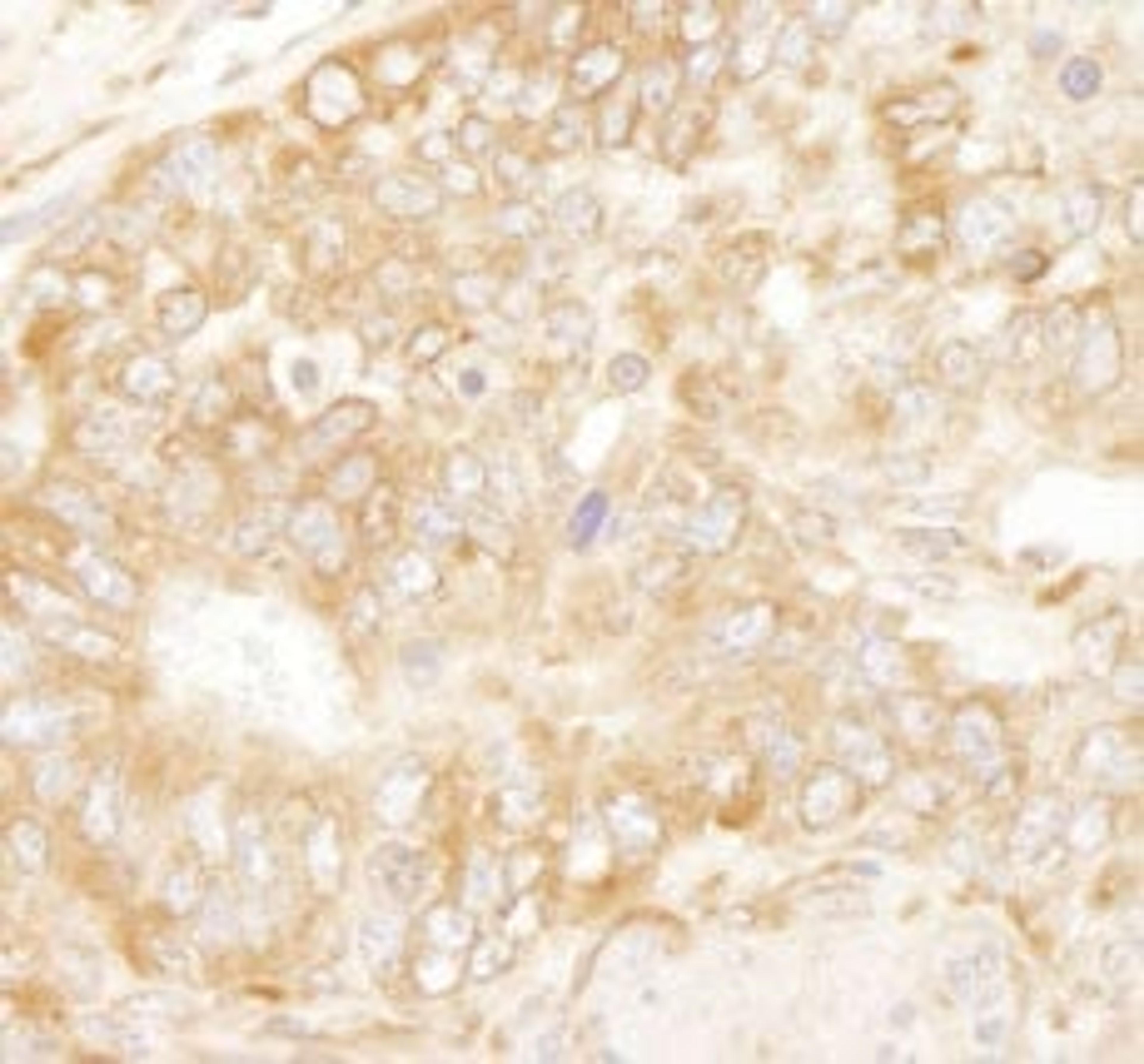 Detection of mouse RPL7 by immunohistochemistry.