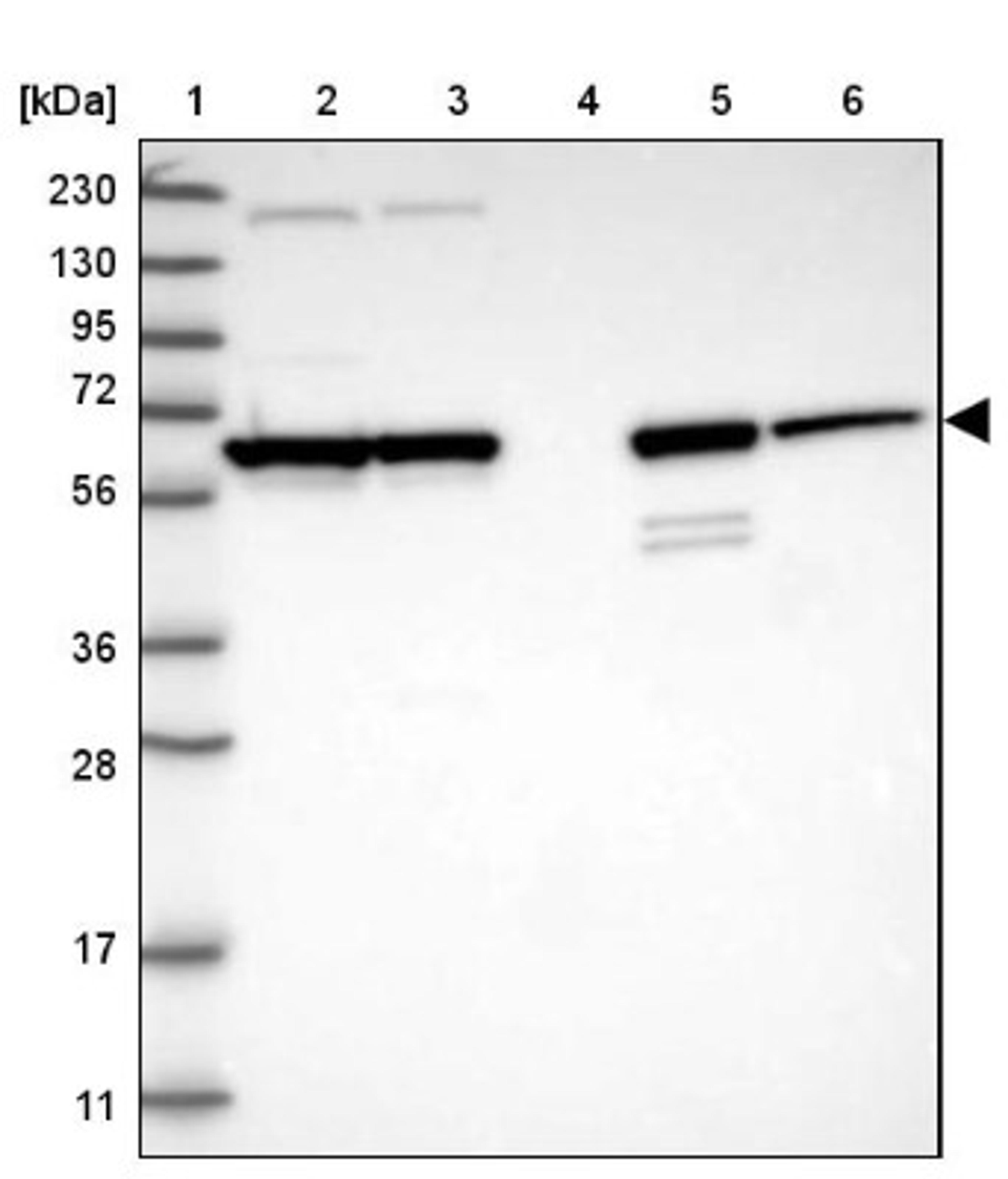 Western Blot: PLD5 Antibody [NBP1-81911] - Lane 1: Marker [kDa] 230, 130, 95, 72, 56, 36, 28, 17, 11<br/>Lane 2: Human cell line RT-4<br/>Lane 3: Human cell line U-251MG sp<br/>Lane 4: Human plasma (IgG/HSA depleted)<br/>Lane 5: Human liver tissue<br/>Lane 6: Human tonsil tissue