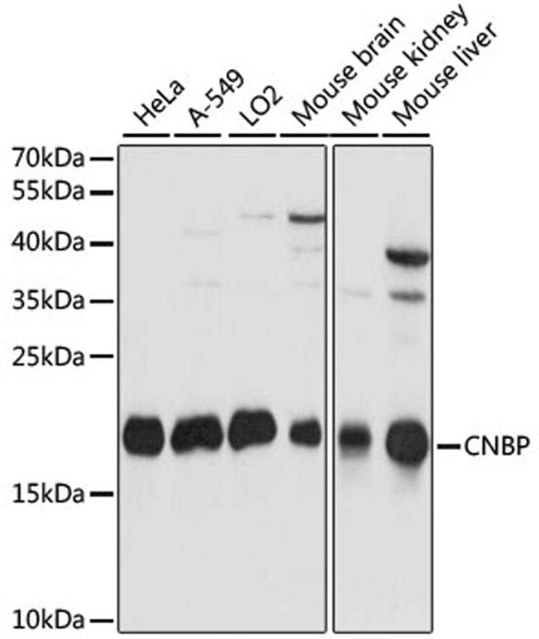 Western blot - CNBP antibody (A15110)