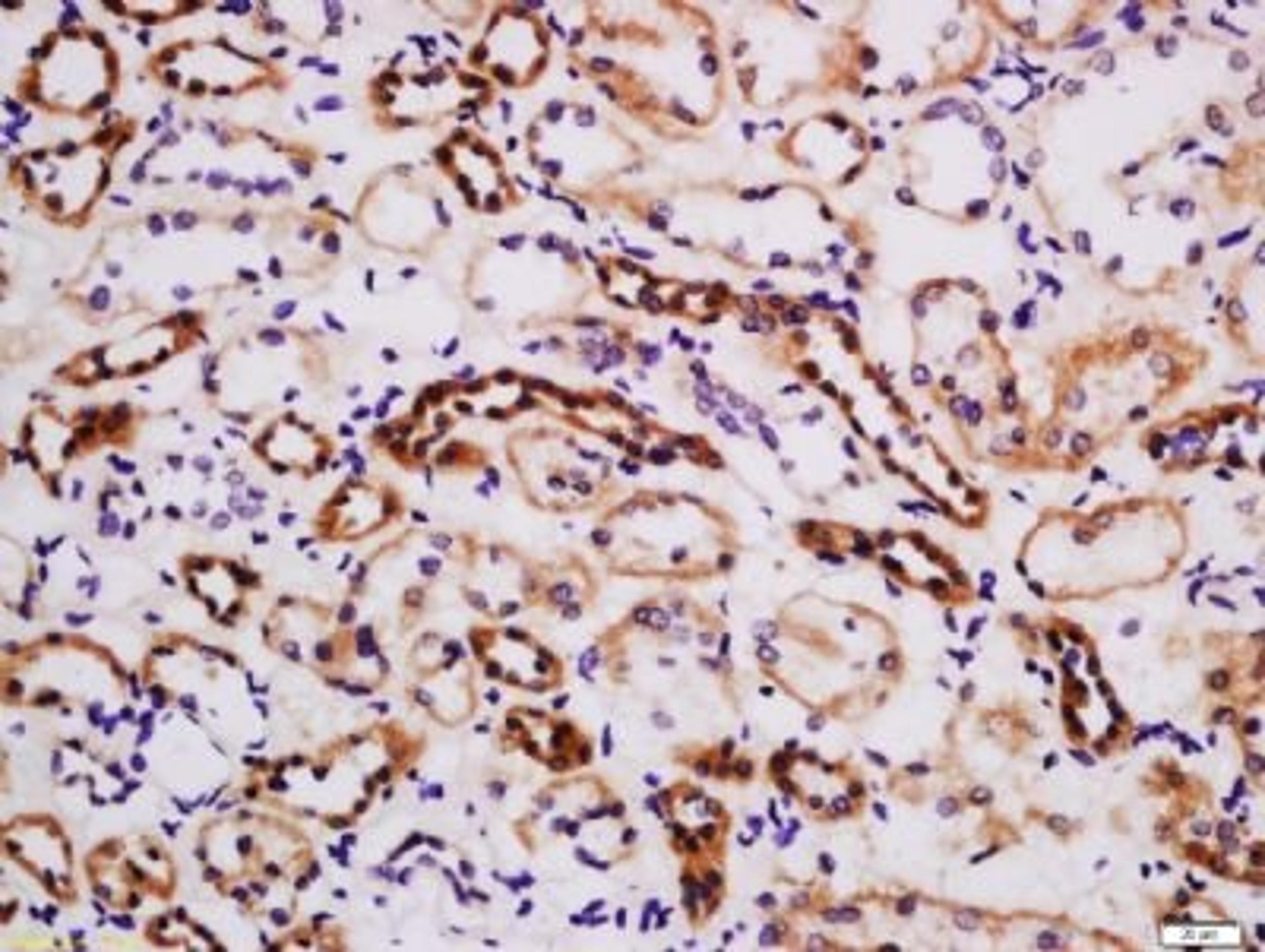 Immunohistochemical staining of human kidney tissue using TIM1 antibody.