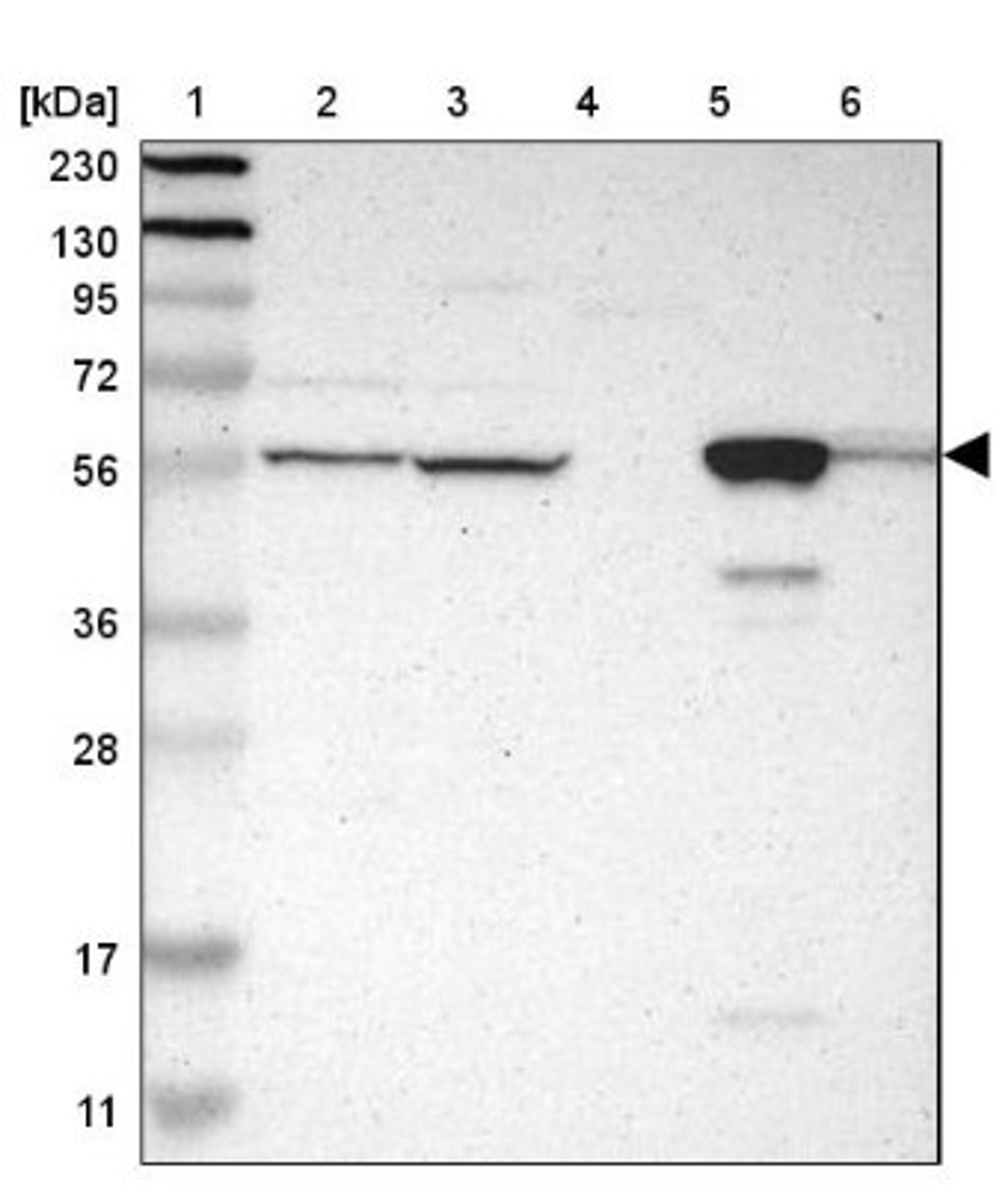 Western Blot: GLYCTK Antibody [NBP1-83292] - Lane 1: Marker [kDa] 230, 130, 95, 72, 56, 36, 28, 17, 11<br/>Lane 2: Human cell line RT-4<br/>Lane 3: Human cell line U-251MG sp<br/>Lane 4: Human plasma (IgG/HSA depleted)<br/>Lane 5: Human liver tissue<br/>Lane 6: Human tonsil tissue