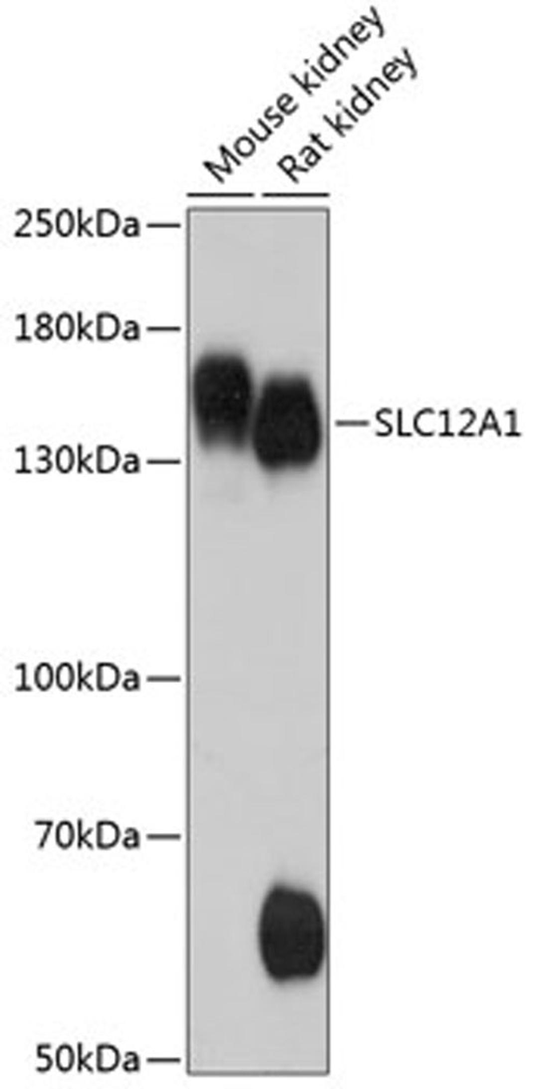 Western blot - SLC12A1 antibody (A12999)