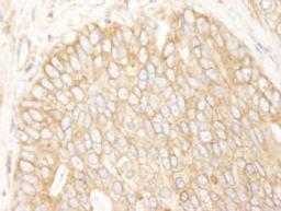 Detection of human Rictor by immunohistochemistry