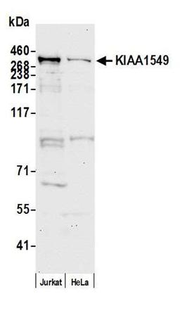 Detection of human KIAA1549 by WB.