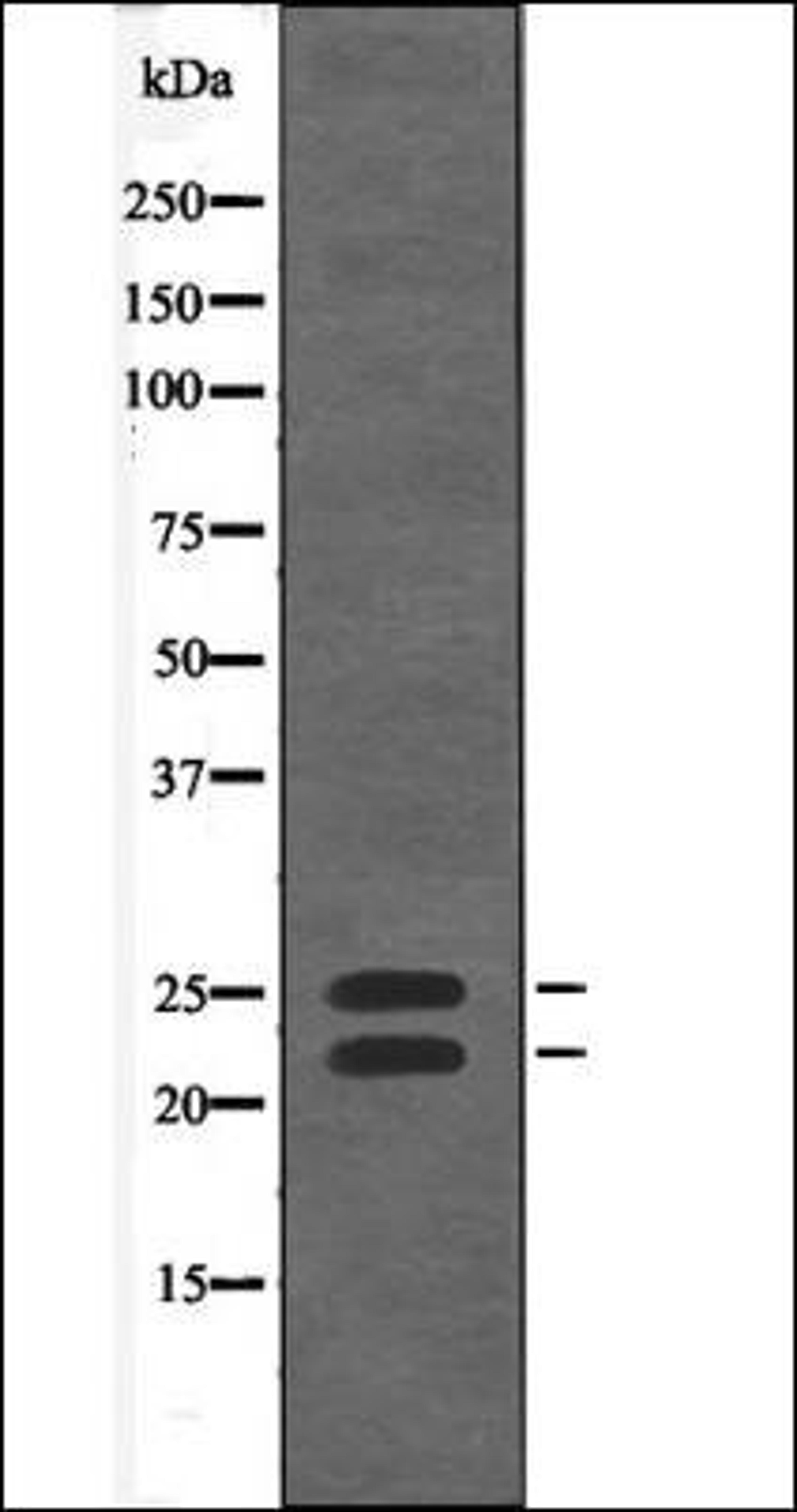 Western blot analysis of EGF treated 293 whole cell lysates using Bim -Phospho-Thr56/116- antibody