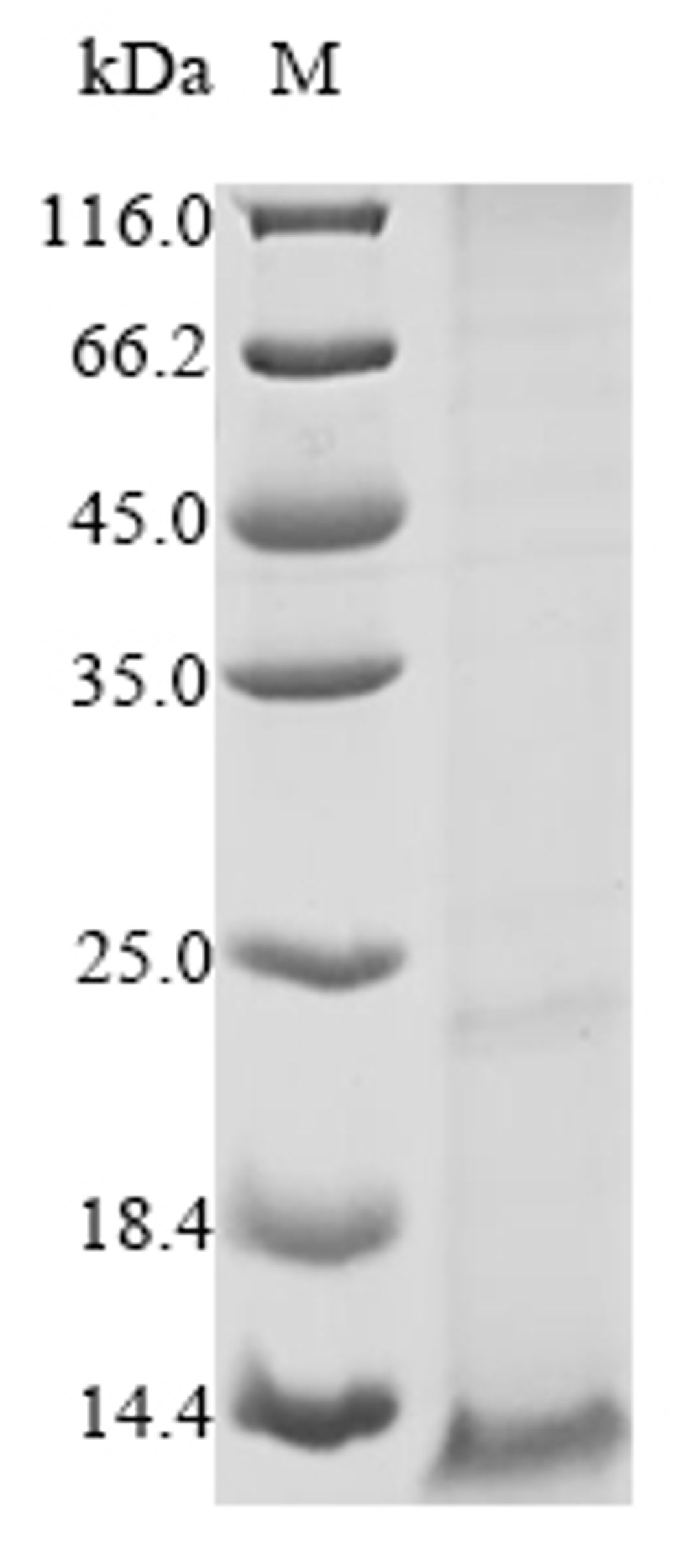 (Tris-Glycine gel) Discontinuous SDS-PAGE (reduced) with 5% enrichment gel and 15% separation gel.